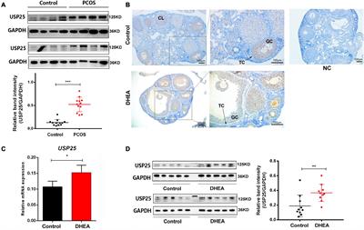 USP25 Regulates the Proliferation and Apoptosis of Ovarian Granulosa Cells in Polycystic Ovary Syndrome by Modulating the PI3K/AKT Pathway via Deubiquitinating PTEN